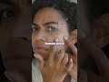 Spironolactone for Acne: Part I