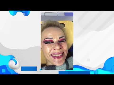 Acrobata que despencou de uma altura de quatro metros grava vídeo após o acidente. Assista!