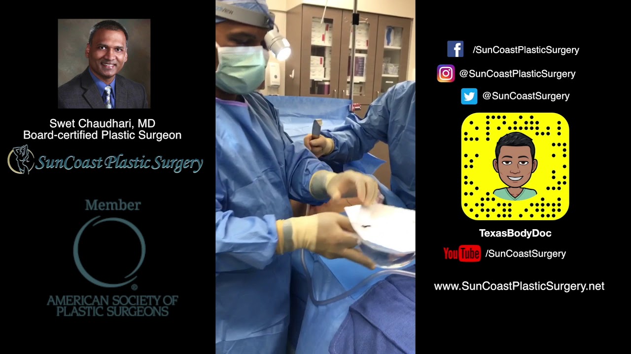 Breast Augmentation with 650 cc silicone implants YouTube