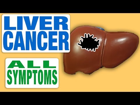 Liver Cancer - All Symptoms