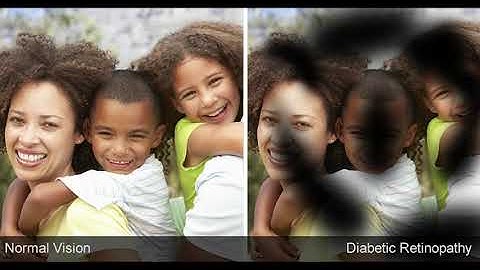 Diabetic Retinopathy Diagnosis | PyTorch Summer Hackathon 2020