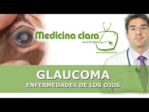 Glaucoma | Visión borrosa | Pérdida de visión | Medicina Clara con el Dr. Bueno |
