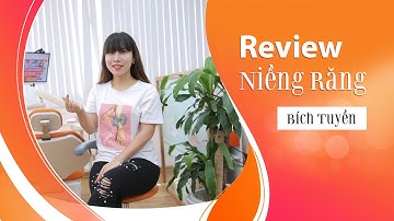 [Review niềng răng]: #84 Kết quả niềng răng của Bích Tuyền