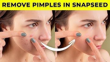 How to remove pimples in snapseed | face smooth editing | smooth skin | remove pimples | snapseed