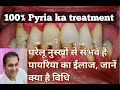 पायरिया से परेशान हैं तो अपनाएं ये घरेलू नुस्खे || Pyria  || Pyorrhea treatment (Home Remedies)