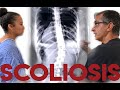 Scoliosis -  Dr. Rahim Chiropractic