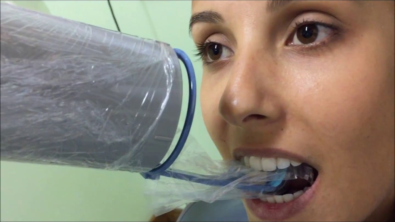 Radiografia Periapical com Posicionadores - Maxila Anterior