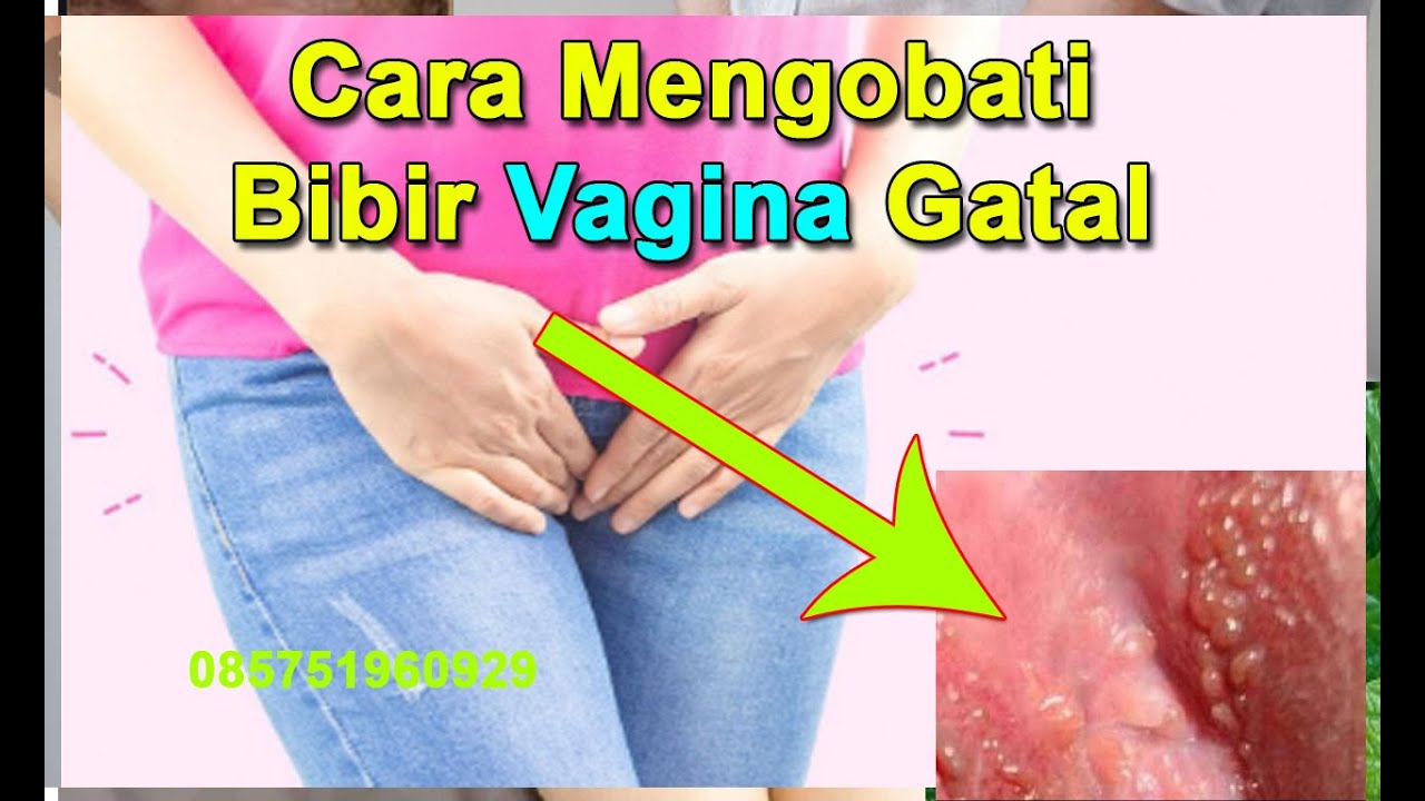 Cara Mengobati Bibir Vagina Gatal