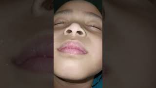 303 Bengkak Tonsil Nayla