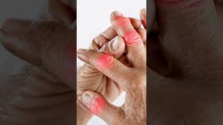 Sleep Problems? Try Ayurvedic Tips! Dr. Pantulu Raghupathi @AyurMithra-r7s