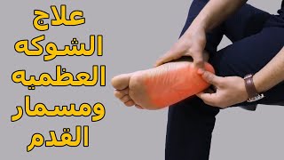 علاج ألم والتهاب الكعب والقدم /التهاب اللفافه الاخمصيه /تخلص من الشوكه العظميه ومسمار القدم