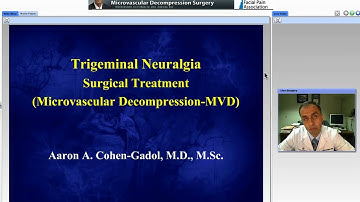 Microvascular Decompression Surgery For Trigeminal Neuralgia (Preview)