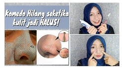 Cara Menghilangkan Komedo dengan Pasta Gigi - Durasi: 6.16. Cara Menghilangkan Komedo dengan Pasta Gigi - Durasi: 6.16.