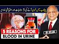 5 Reasons For Blood In Urine پیشاب میں خون آنے کی 5 وجوہات اور احتیاطی تدابیر Drjeelani 