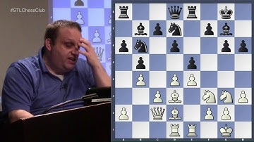 Karpov and his Ruy Lopez | Mastering the Middlegame - GM Ben Finegold