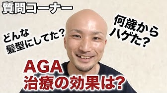 若はげ Youtube 若はげ Youtube
