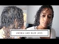 Anemia and Hair Loss + My Natural Hair Journey