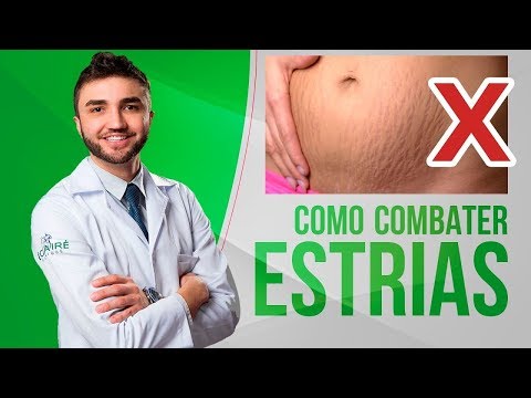 Vídeo: Estrias Nos Seios: Causas, Tratamento, Prevenção E Muito Mais