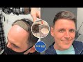 How To Colour/Color Hair System | Before/After Non-Surgical Hair Replacement System Men/Women UK/USA