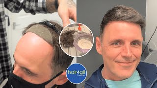 How To Colour/Color Hair System | Before/After Non-Surgical Hair Replacement System Men/Women UK/USA