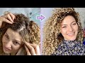 Common Causes of Dry Hair and Scalp + Solutions