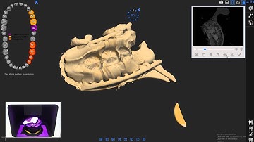 DOF Freedom HD - Dental Scanner (Impression)