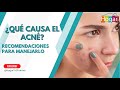 Causas del acne y como mejorarlo - HogarTv producido por Juan Gonzalo Angel Restrepo