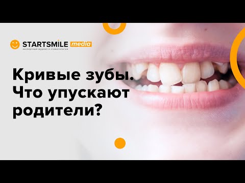 Кривые зубы у детей | Лечение и последствия