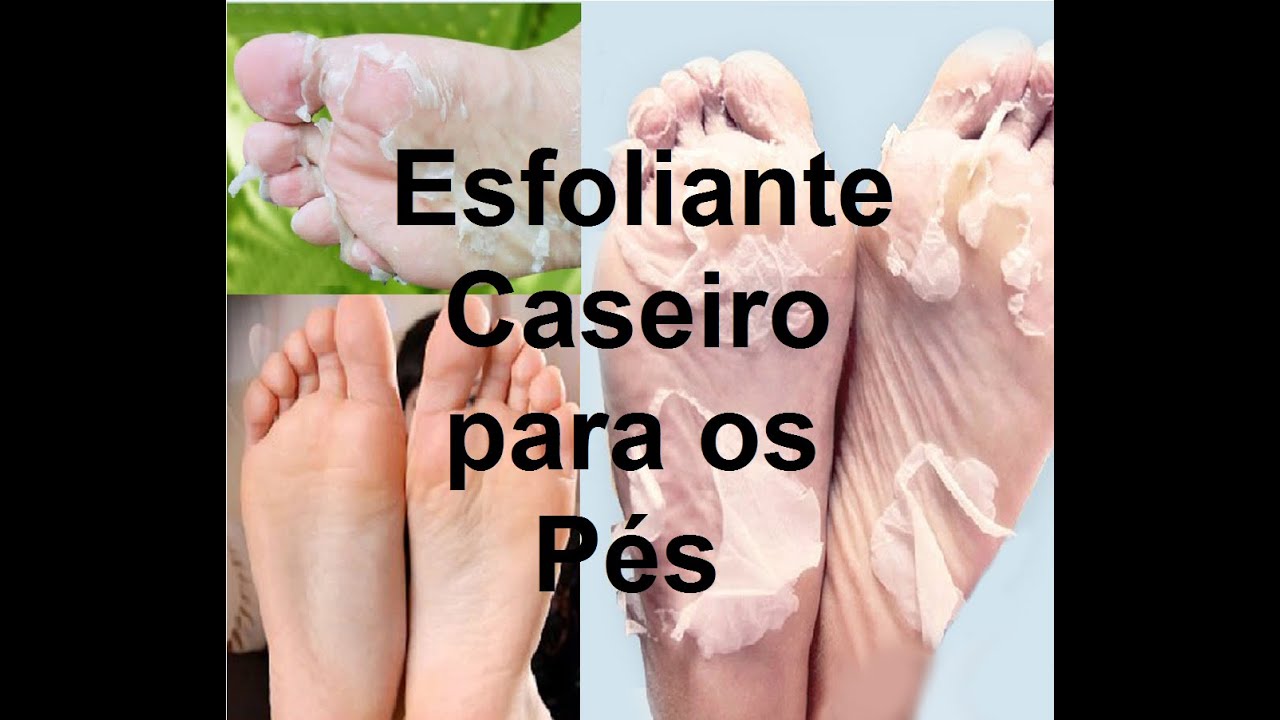 esfoliante para os pés caseiro