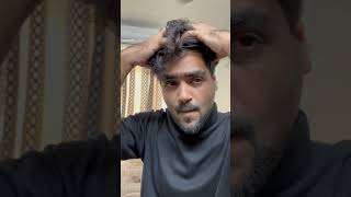 Will Anti Grey Hair Serum Reduce My White Hairs? #shorts
