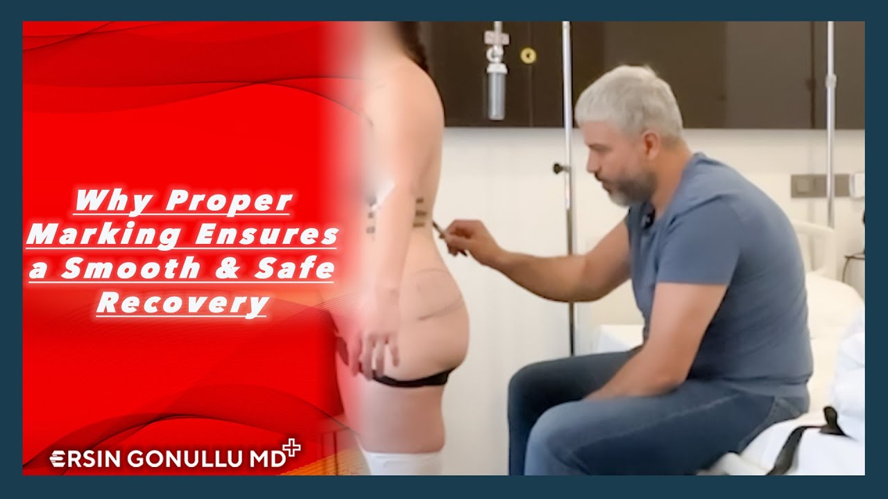 Proper Marking Why Proper Marking Ensures a Smooth & Safe Recovery #safebbl #beauty # ...