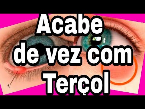 Tratamento para terçol: pomadas, opções caseiras e cuidados - Tua