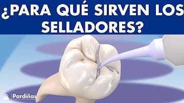 ¿Cuál es el proceso de sellado?