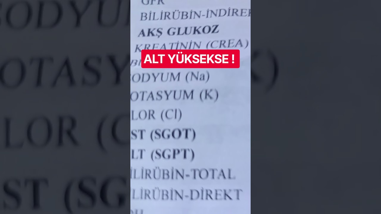 ALT YÜKSEKSE 10 NEDEN !