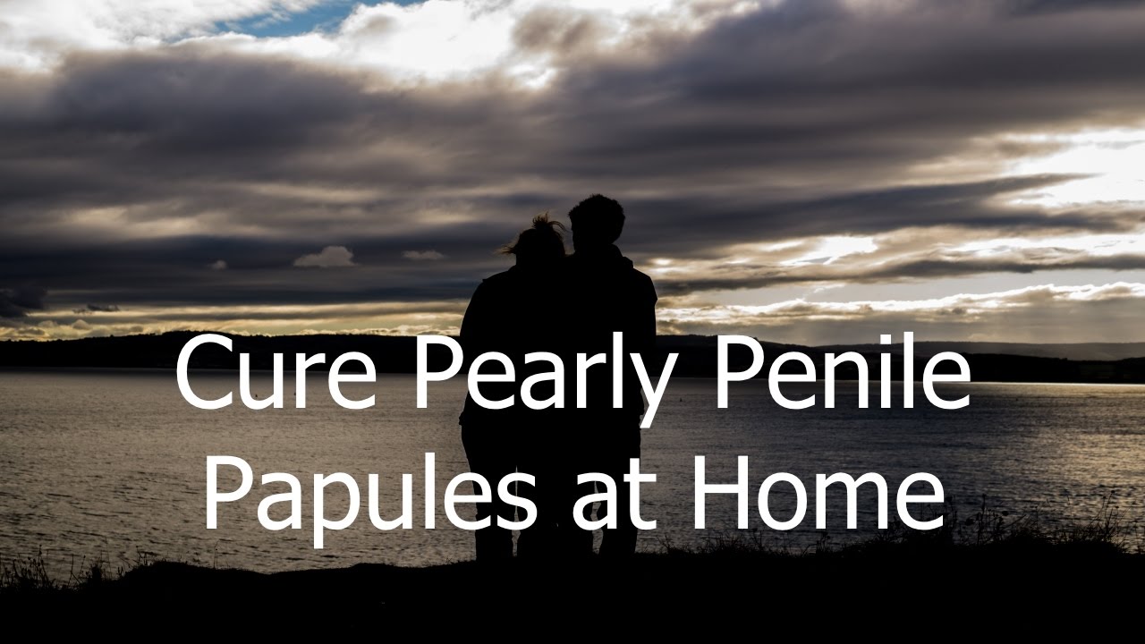 How I Removed My Pearly Penile Papules Ebook