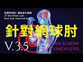 針對網球肘或肱骨外上髁炎 (Tennis Elbow &amp; Epicondylitis) - 3.5版本 - 請閱讀影片使用說明 (建議使用耳機聆聽)