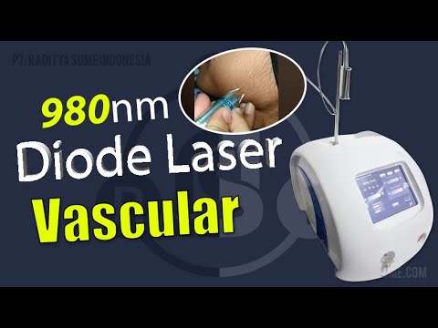 980NM Diode Laser Vascular Penghapusan Vena Spider Vein