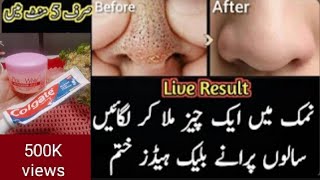 Easy hacks to Remove Blackhead Clogged pores in 5 minet Best way to Remove Blackheads with Toothpast