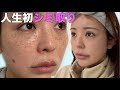 【人生初】シミ取りをしてきた！術後直後〜完成までを全部公開する！！！