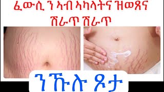 #ድሕሪ ሕርሲ ኣብ ኣካላትና ዝወጸና ሽራጥ ሽራጥ ከምኡ’ውን ካብ ሃንደበታዊ ክብደት ምጉዳል (ምውሳኽ)ንኹሉ ጾታ How to Remove stretch marks