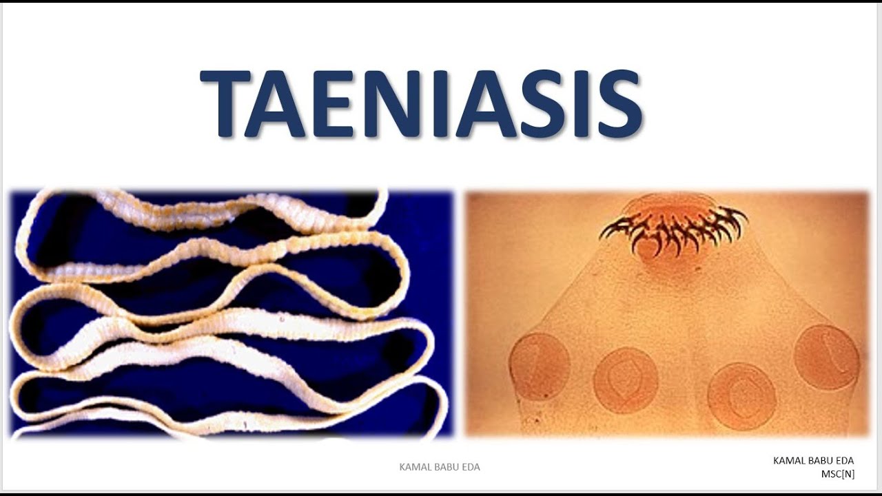 Teniasis jelei és tünetei - Kezelés Teniosis teniarinhoz klinikai ajánlások
