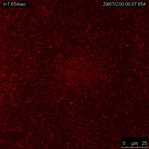 E.coli Collective Motion