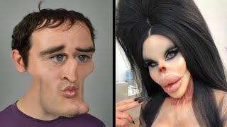 10 ऐसे लोग जिन्होने ख़ुद को जानवर में बदल लिया 10 People Who Took Plastic Surgery Too Far