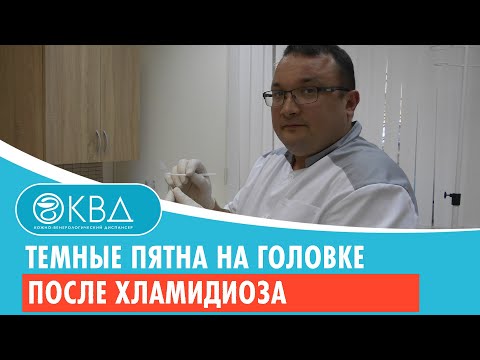 🙁 Темные пятна на головке после хламидиоза. Клинический случай №427