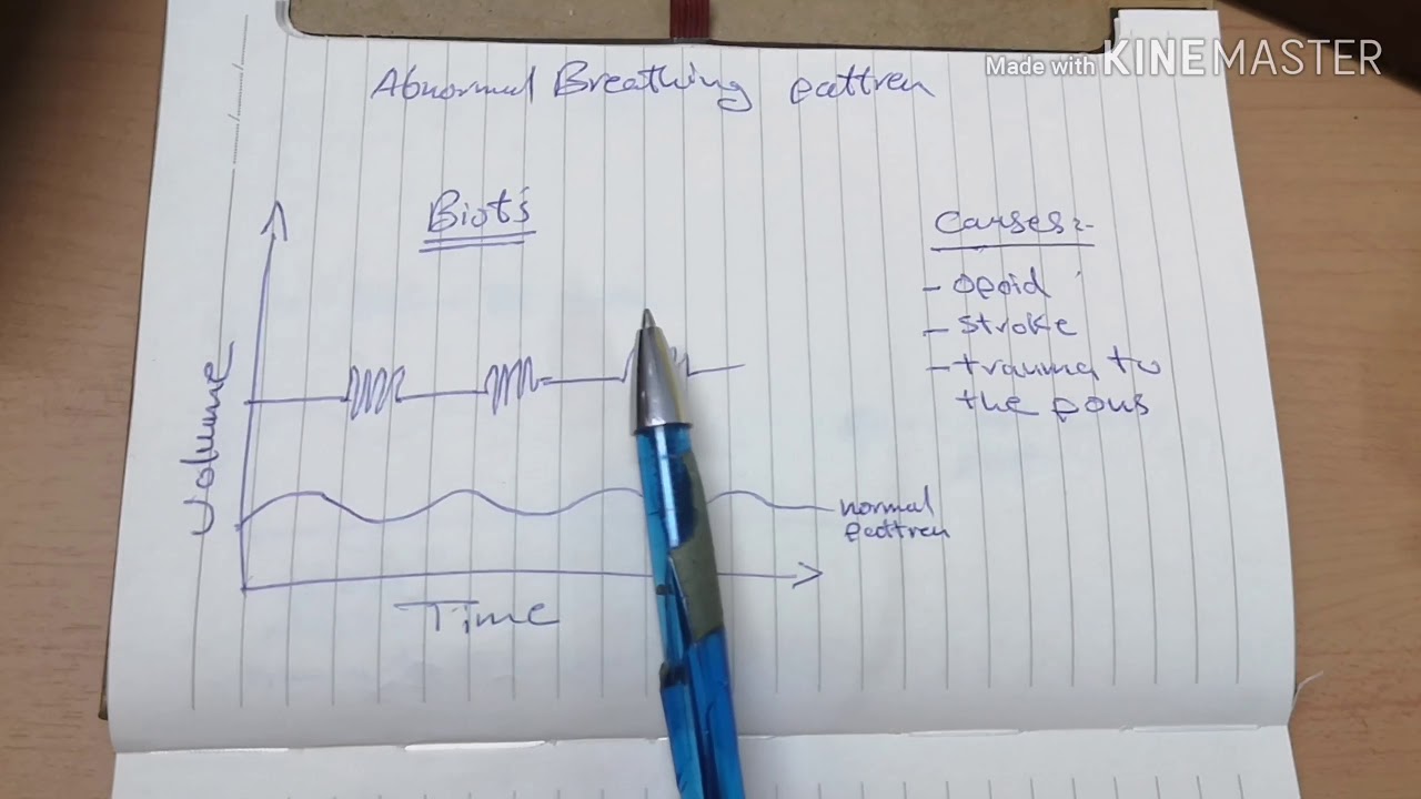 Biot's breathing pattren in real patient - YouTube