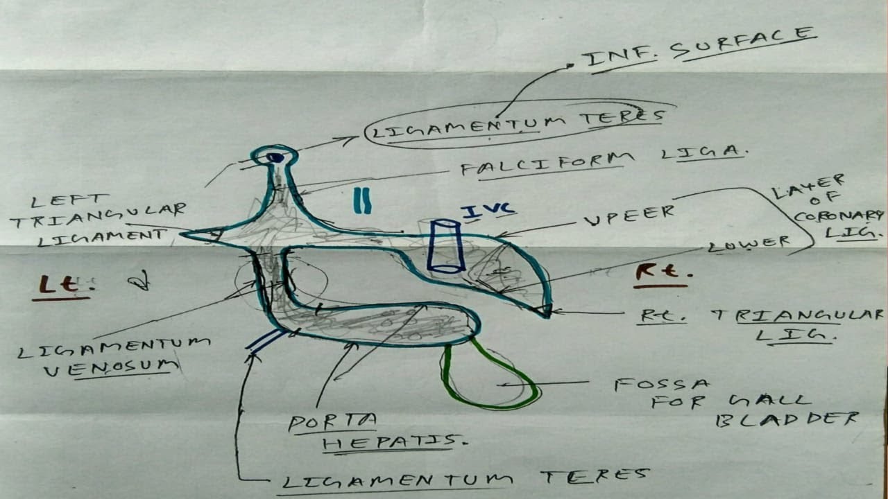 Tracing of ligament of liver- 8, Diagram | TCML