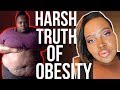 The Scary Side of Obesity (Charlie Gold's Story)