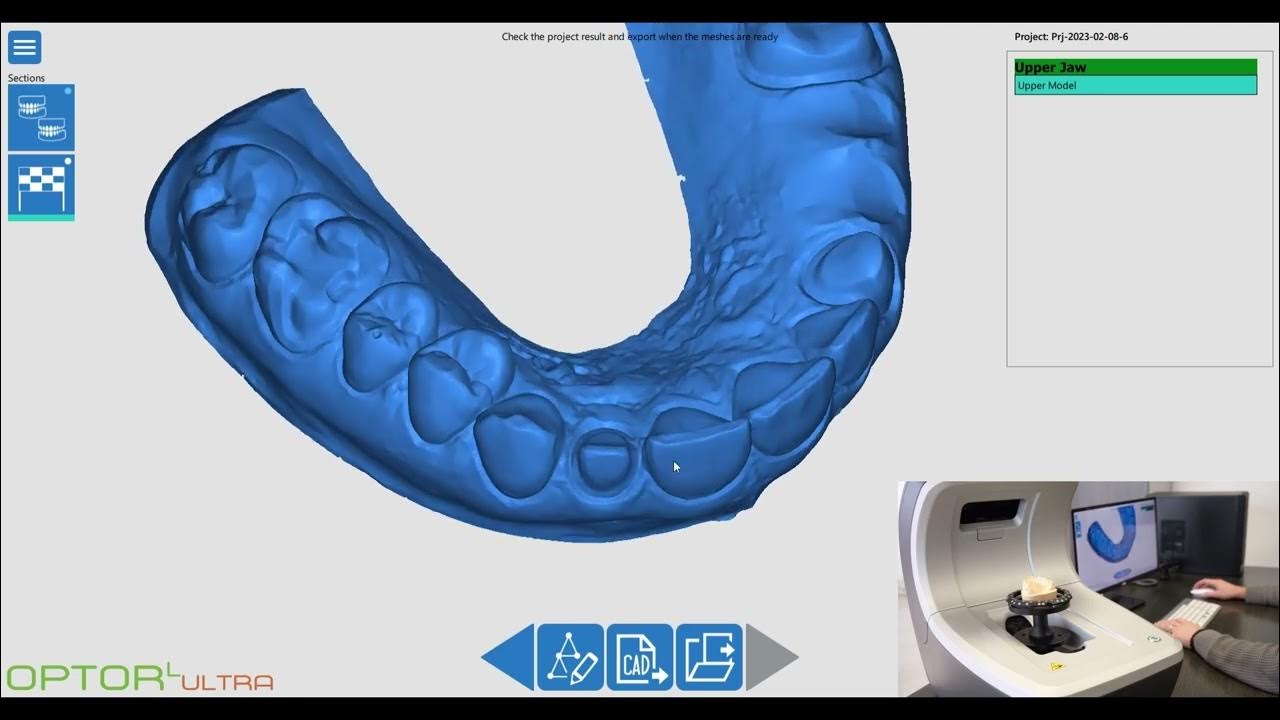 Innovazione Odontotecnica Progetti con Optor Lab Scanner YouTube