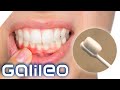 Welchen Vorteil hat eine Nano-Zahnbürste? 5 Tipps vom Zahnarzt | Galileo | ProSieben