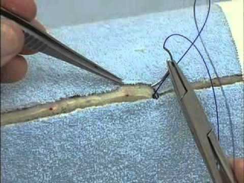 Continuous Suture Patterns: Subcuticular